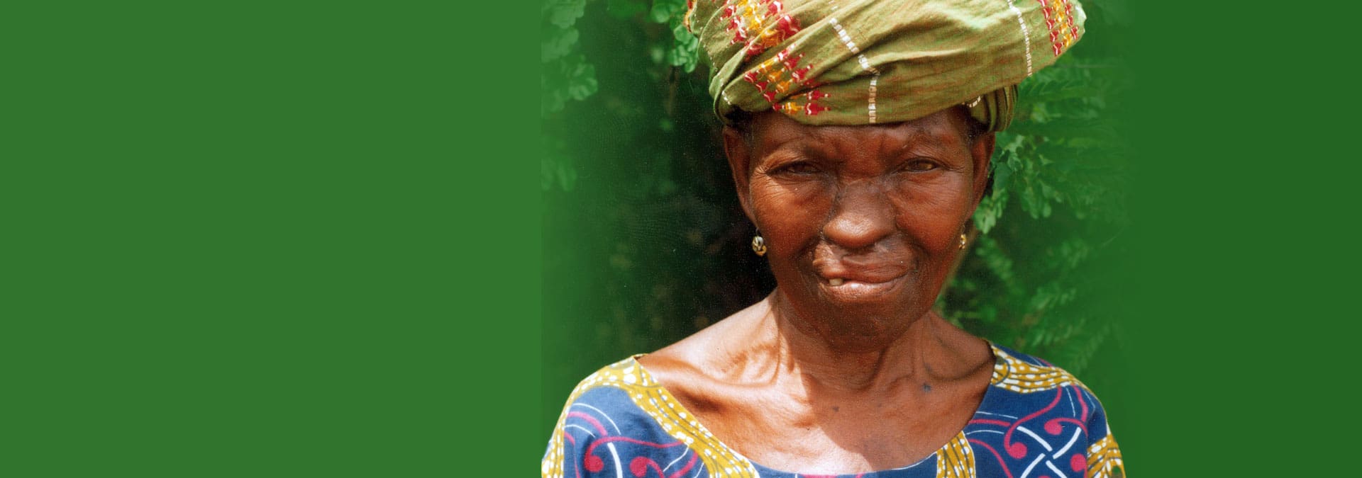 2000
Felisia, Benin
2000 · Återfådd värdighet
Efter att ha levt utan näsa i mer än 50 år återvände Felisia hem med högt upprätt huvud.