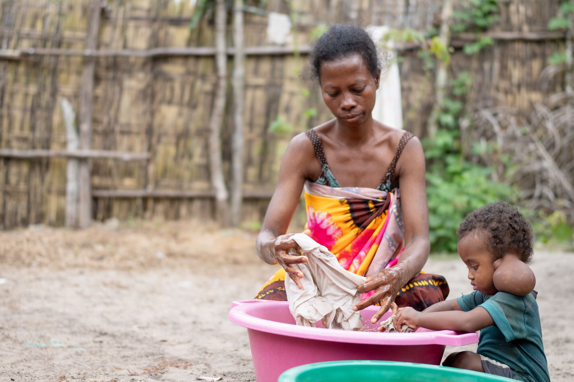 As Armella grew, so did the tumor behind her ear, eventually becoming so heavy that she struggled to hold up her head.