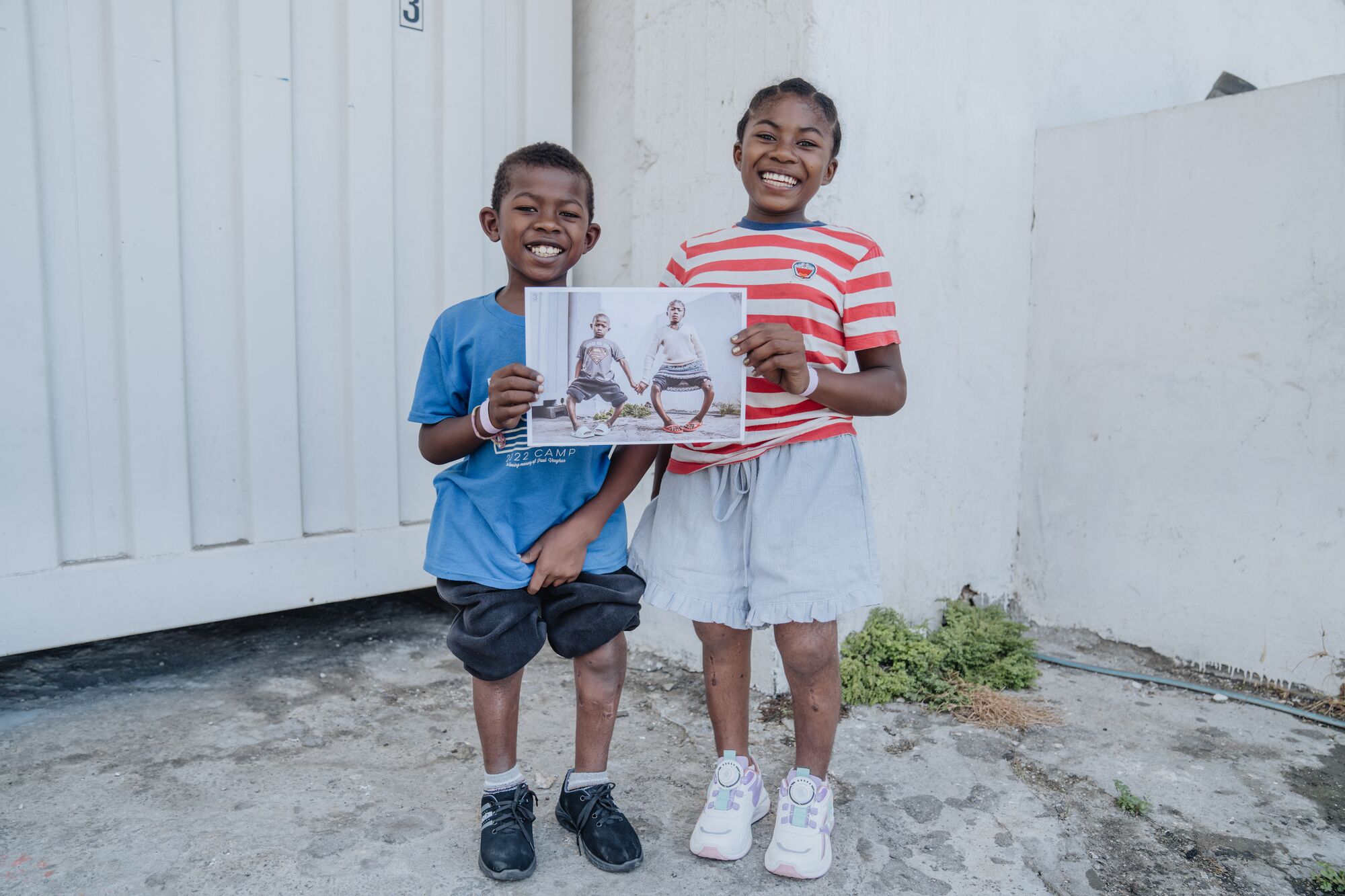 “They'll be able to play with their friends at school without feeling embarrassed.”
Christophe